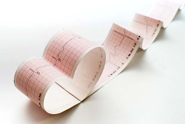 Ekg Internist Dr. Walter Gritsch Dr. Sonja Lang Praxis Innsbruck und Fulpmes Leistungstest Praxis Fulpmes Stubaital Internist Dr. Gritsch Dr. Lang Facharzt für Innere Medizin und Allgemeinmedizin Mobil